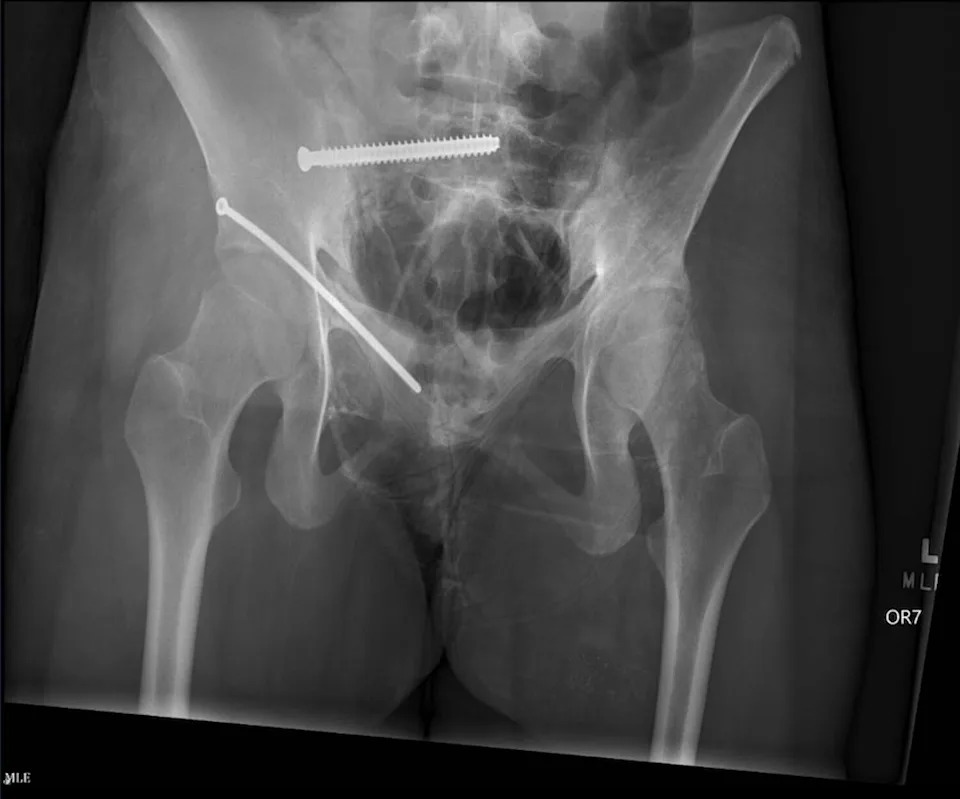 An x-ray shared by the family of Millicent 